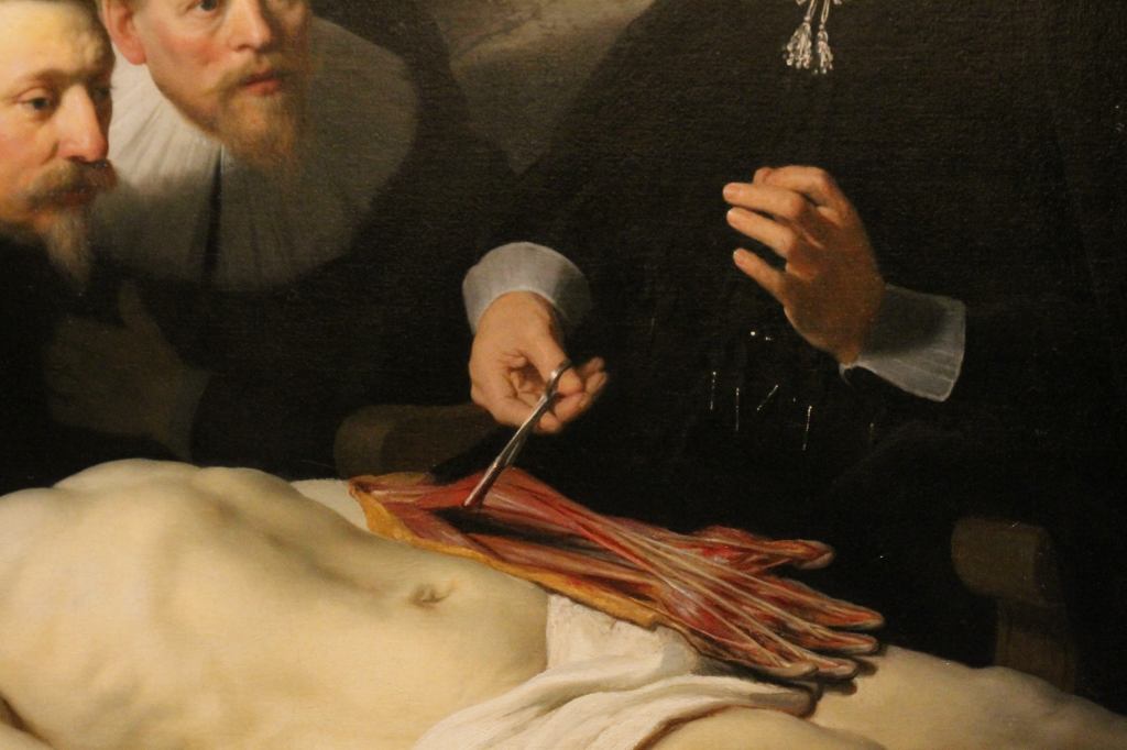 The Anatomy Lesson of Dr Nicolaes Tulp